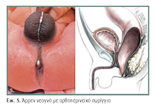 Ανατομία του πρωκτού σεξ