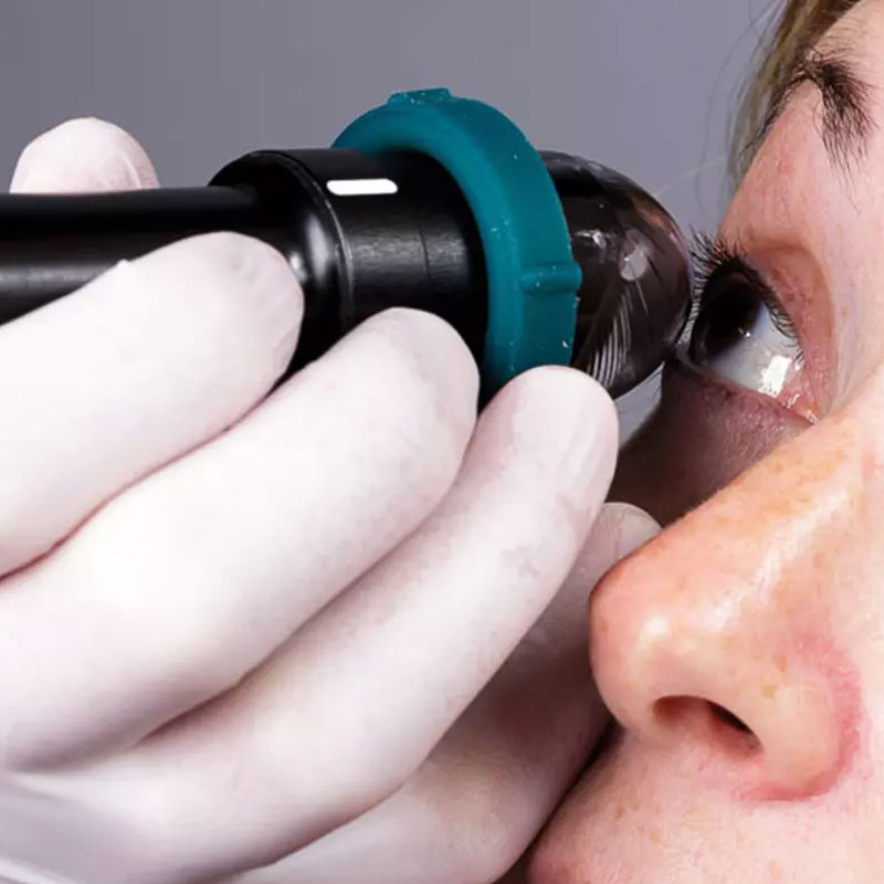 ABSOLU A-B-UBM ULTRASOUND – UBM 50 MHZ LINEAR