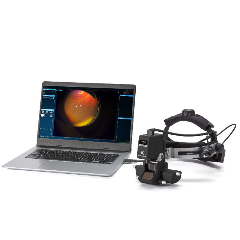 KEELER VANTAGE-PLUS DIGITAL
